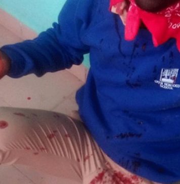 Côte d’Ivoire / Affrontements communautaires à Agboville : Plusieurs blessés graves, écoles et marchés fermés