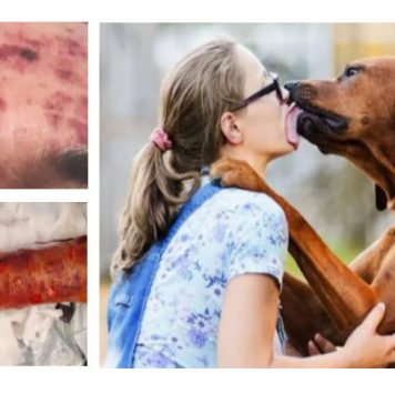 Sa peau pourrit après avoir été léché par son chien